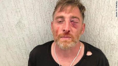 TV Pirveli released this image of Lashkarava's injuries before his death.